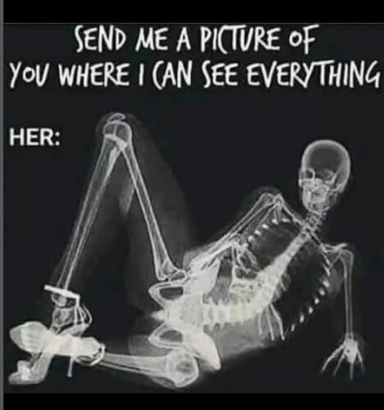 xray_dating pic
